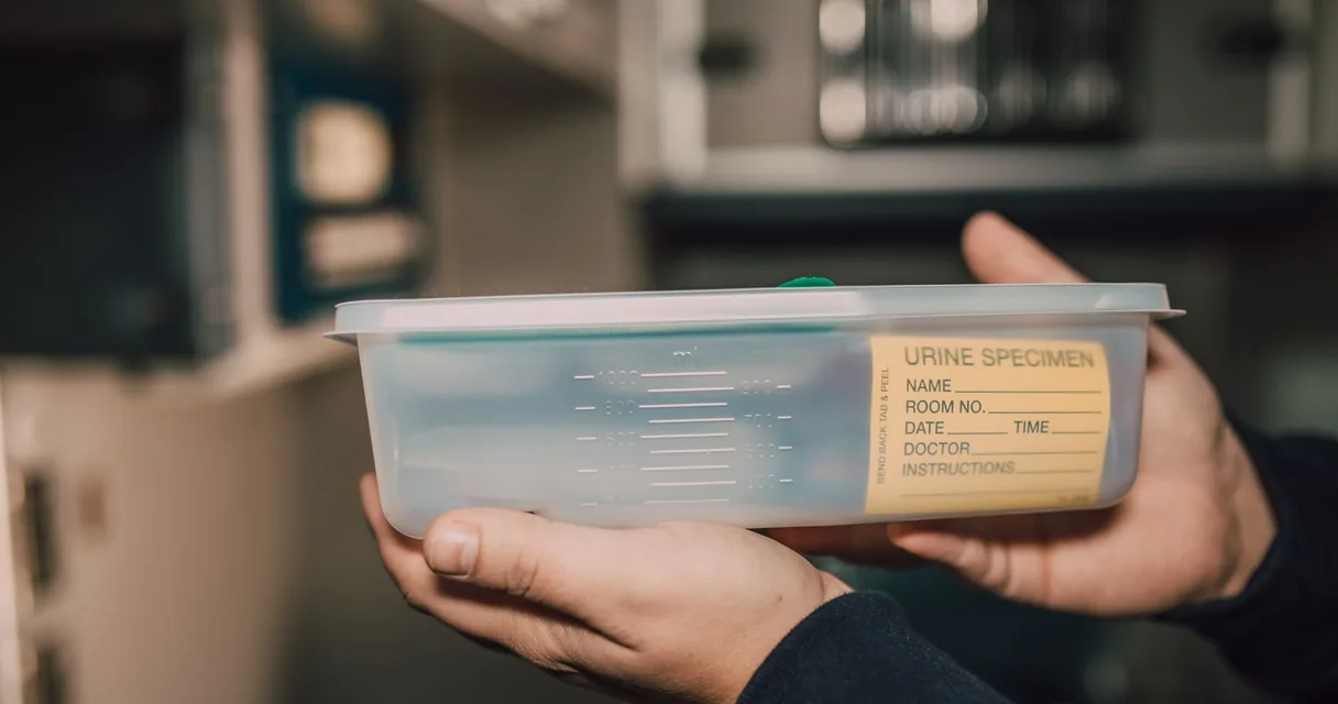 Mãos segurando um recipiente de coleta de amostra de laboratório