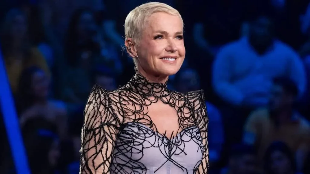 Estado de saúde de Xuxa após cirurgia na coluna