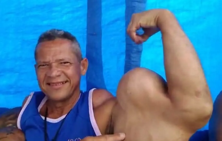 Morre Arlindo Anomalia, o “Popeye brasileiro”, aos 55 anos